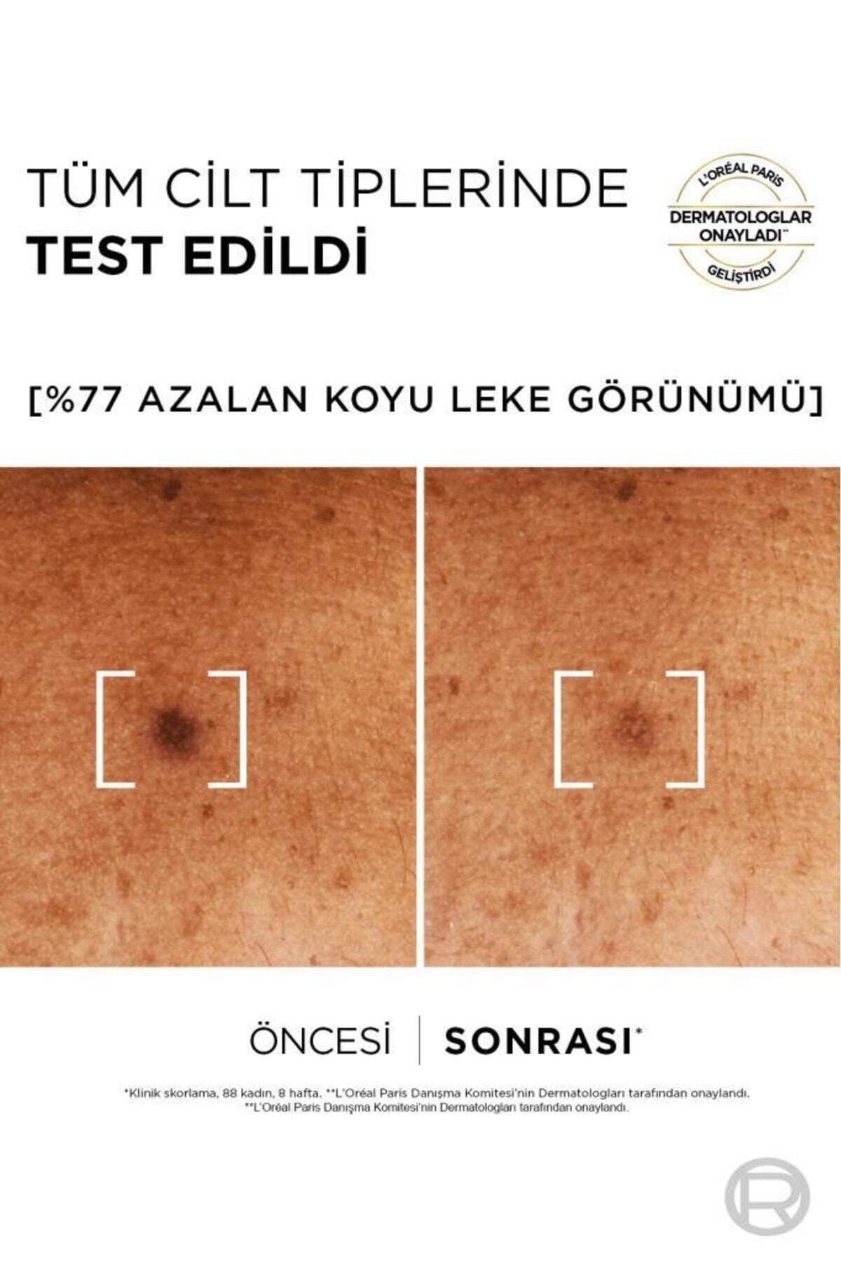 L'Oreal Paris Bright Reveal Sivilce, Güneş, Yaşlanma Lekelerinde Etkili Koyu Leke Karşıtı Serum 10%Niasinamid 30ml