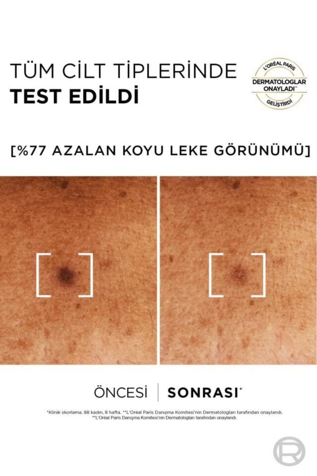L'Oreal Paris Bright Reveal Sivilce, Güneş, Yaşlanma Lekelerinde Etkili Koyu Leke Karşıtı Serum 10%Niasinamid 30ml